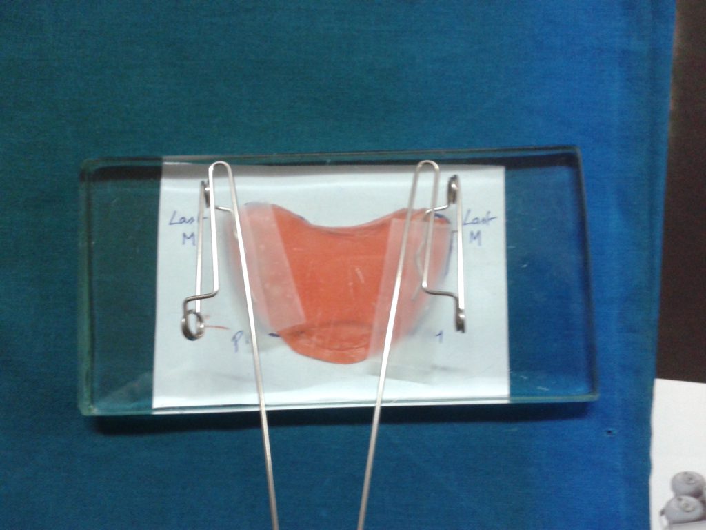 Image of first carousel
