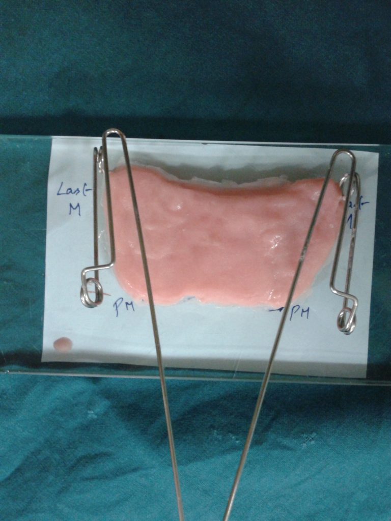 Image of first carousel